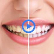 5 semplici trucchi per avere i denti più bianchi