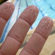 Perché la pelle delle dita si raggrinzisce in acqua?