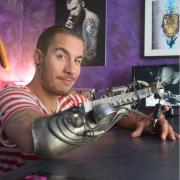 Ecco la prima protesi per tatuaggi al mondo