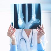 Osteoporosi e fragilità ossea: è affidabile la MOC?