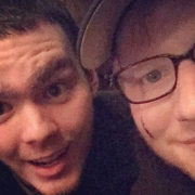 Ed Sheeran ferito al volto dalla principessa Beatrice
