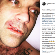 Robbie Williams... ferito da un computer!