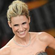 Michelle Hunziker ha la dentiera? Ecco la sua risposta!