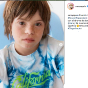 Scopri chi è Patrick, il bimbo con sindrome di Down scelto come modello da Zara
