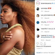 Serena Williams senza filtri: il suo forte messaggio per la bellezza al naturale!