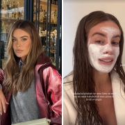 L’incidente di Sophie Codegoni: “Mi sono spaccata mezza gamba”