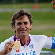 Alex Zanardi: ecco come sta davvero