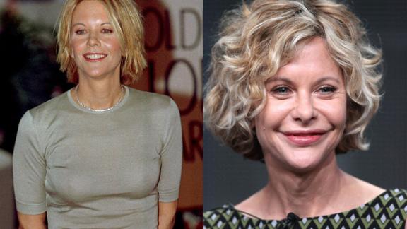 Vip e chirurgia estetica: il prima e il dopo