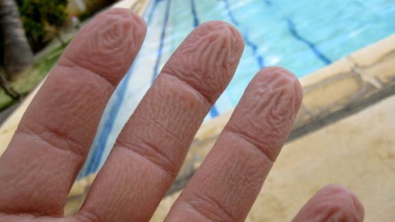 Perché la pelle delle dita si riggrinzisce in acqua?
