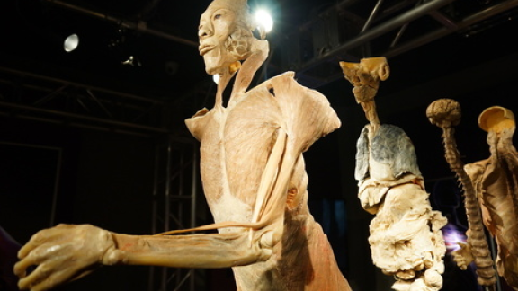 "Real Bodies". Troppi visitatori impressionabili, allestita un'infermeria