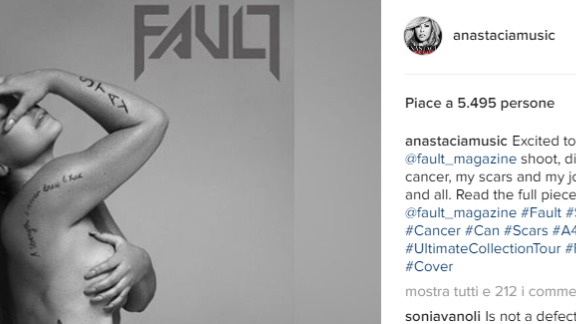 Anastacia nuda per Fault Magazine. "Le mie cicatrici sono parte di me"