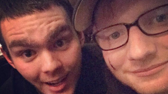 Ed Sheeran ferito al volto dalla principessa Beatrice