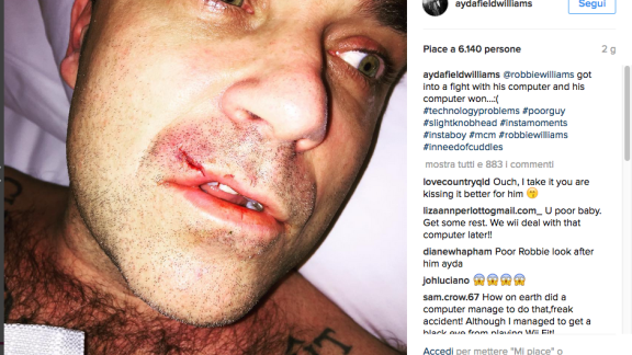 Robbie Williams... ferito da un computer!