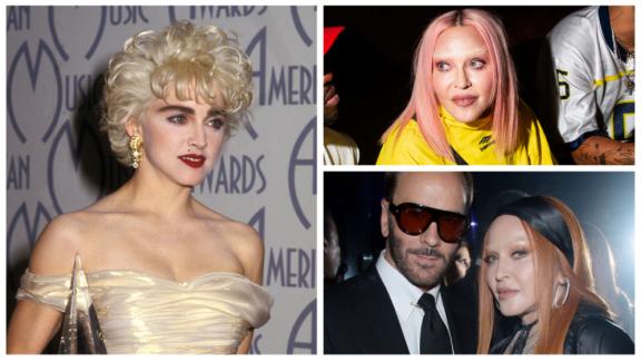 Madonna, che faccia! I chirurghi plastici dicono la loro