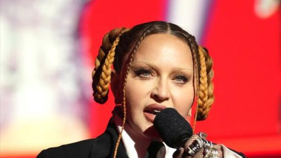 Madonna cede e inizia ad ammettere la verità sui suoi ritocchini