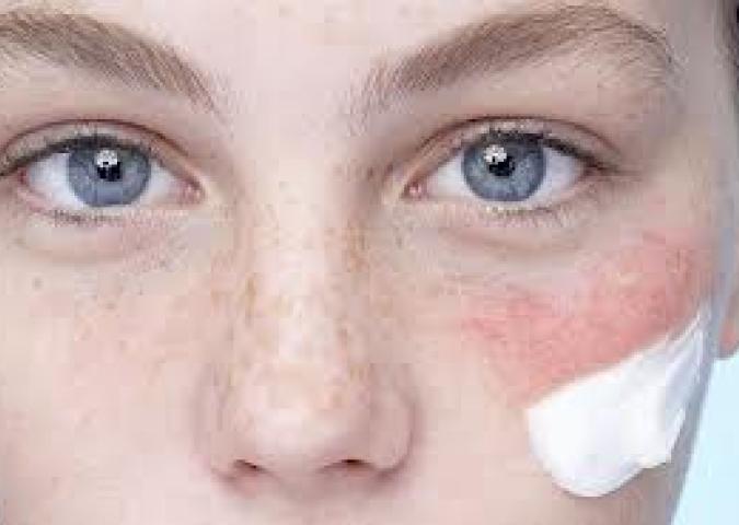 DOTT.SSA BUCCI Dermatologo plastico ed Esperto di Starbene, quale crema scegliere per una pelle sensibile e intollerante? 