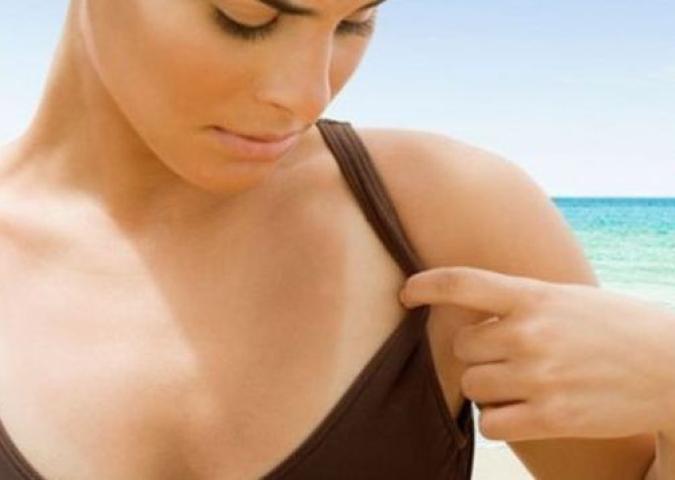 DOTT.SSA BUCCI Dermatologo plastico ed Esperto di Starbene, come prevenire l’eritema solare?