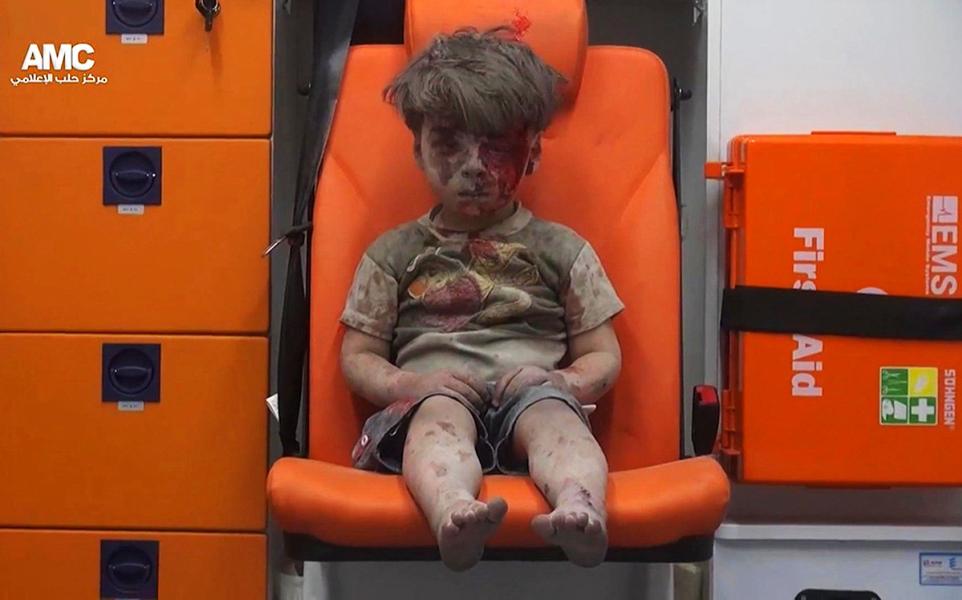 Omran Daqneesh.